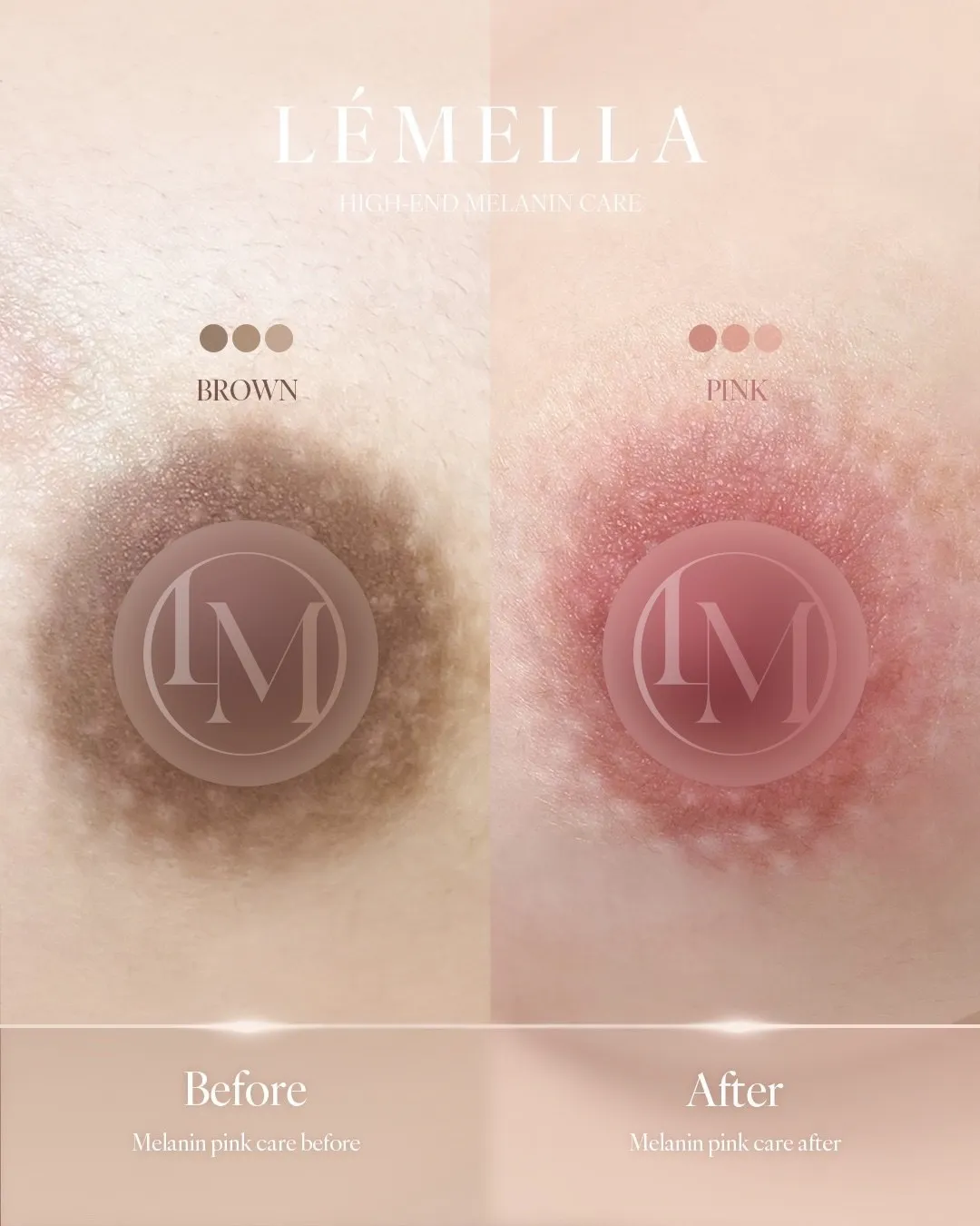 まもなく終了！【完売→増枠しました】大人気「ルメラ」特大割引キャンペーン